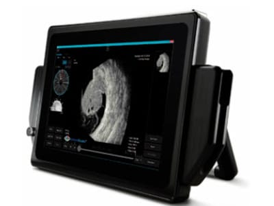 Sonomed Escalon Vupad Portable B Scan Ultrasound | EMS