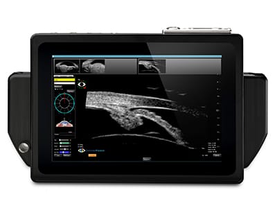 Sonomed Escalon Vupad Portable Ubm Ultrasound 1 | EMS