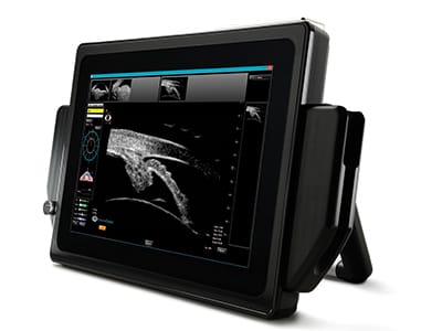 Sonomed Escalon Vupad Portable Ubm Ultrasound 2 | EMS
