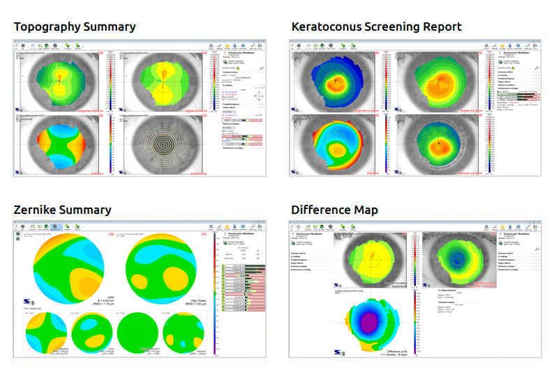 News4cornealmaps | Enhanced Medical Services