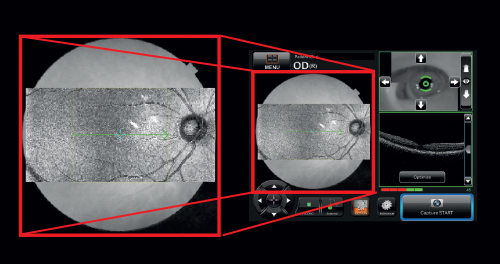 Maestro2 Livefundus | Enhanced Medical Services