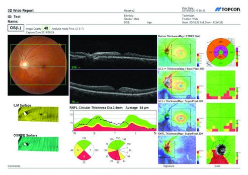 Maestro2 Widefield | Enhanced Medical Services