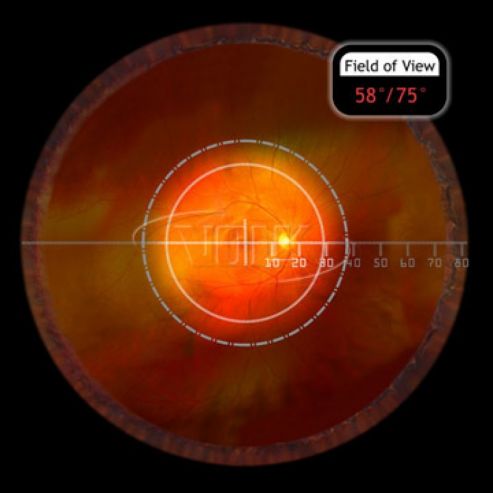 V30lc 30d | Enhanced Medical Services